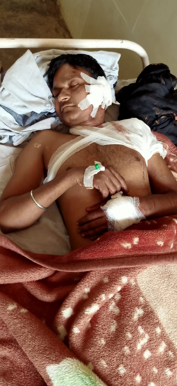 Katni: कैमोर में पति-पत्नी पर पड़ोसी ने किया कुल्हाड़ी से हमला पत्नी की मौत, पति गंभीर 22 IMG 20201002 WA0014