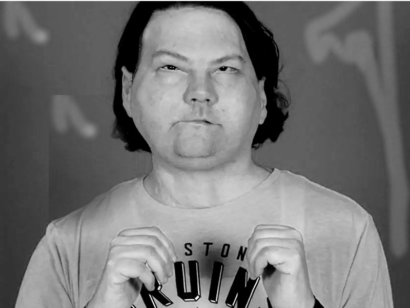 04 02 2021 face transplant