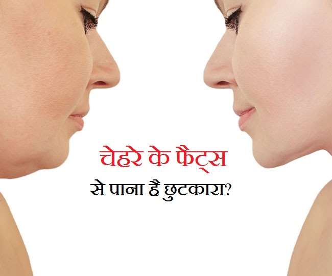 face fats remedy