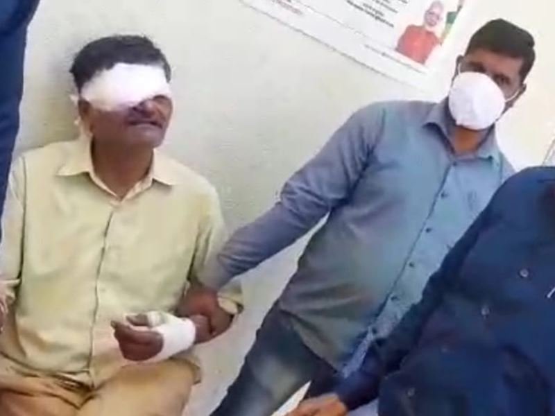 OMG: एक्सीडेंट में घायल था बाबू पर रिश्वत नहीं छोड़ी और 20 हजार लेते रंगे हाथ पकड़ा गया 5 03 03 2021 gwalior babu taking bribe news 202133 143347