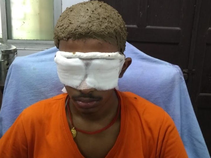 Black Fungus Ayurvedic Treatment: जोंक से होगा ब्लैक फंगस का इलाज, जानिए क्या बोले डॉक्टर 22 blacknew2jpg 1621236348