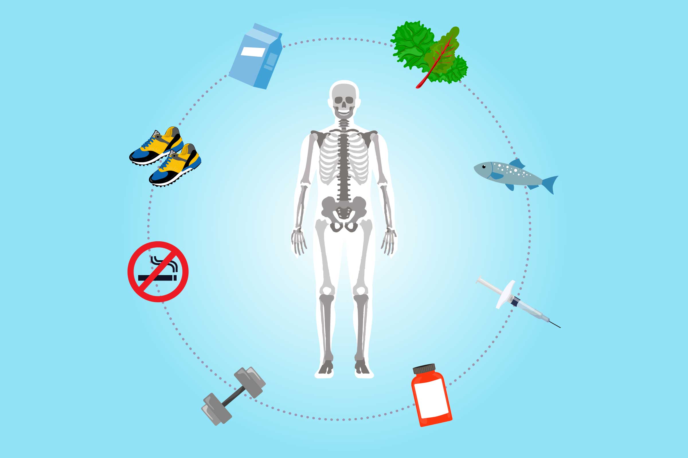 0919 Osteoporosis Prevention