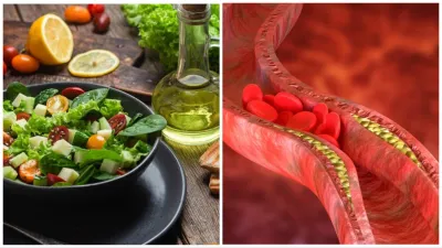 cholestrol level 1691151273