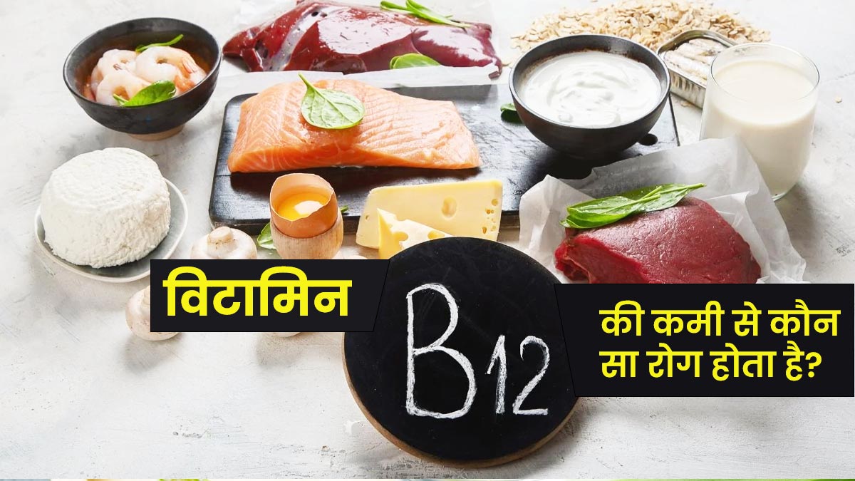 चलो खुद को स्वस्थ रखें, विटामिन बी12 की कमी से बचने के लिए अपनाएं आसान उपाय 22 vitamin b ki kami
