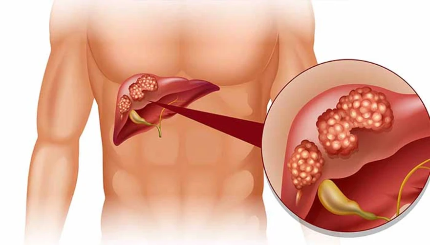 Liver Function Tests hindi1715951381