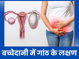 bachedani me ganth ke lakshan