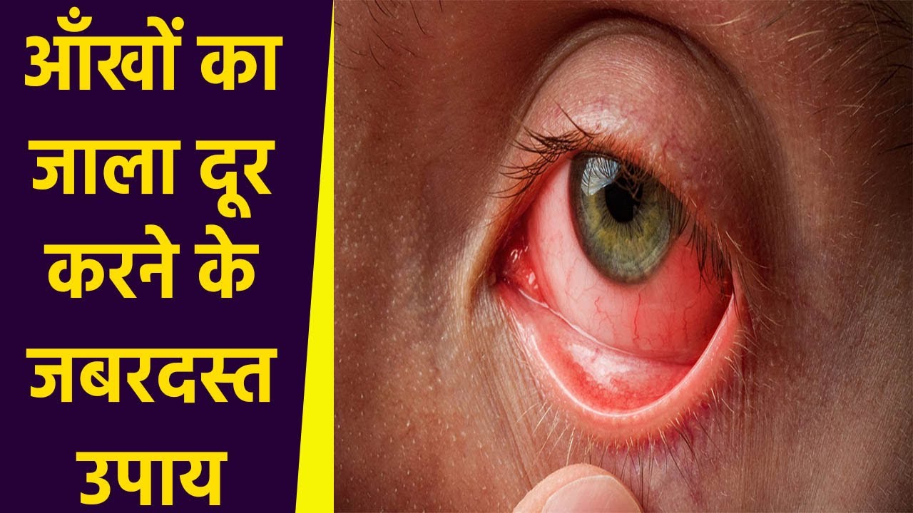 know how to get relief Instantly in eye dryness