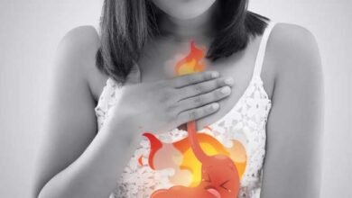 how to handle acidity problems