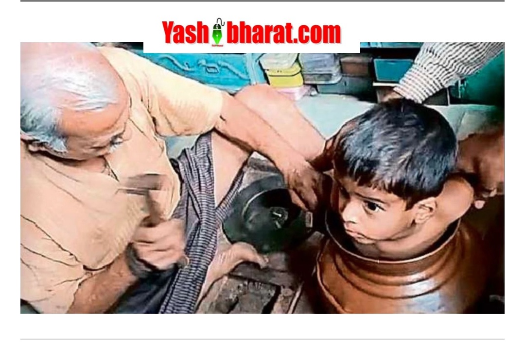 सागर में मासूम की 'घाघर वाली ठंडक' बनी मुसीबत, बर्तन काटकर निकाला गया बाहर