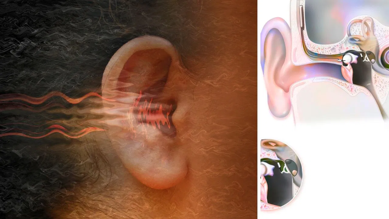 Valsalva Maneuver: बिना दवा, बिना दर्द कुछ सेकेंड में बंद कान खोलने की आसान और असरदार तकनीक