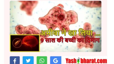 दिमाग खाने वाले अमीबा से 9 साल की बच्ची की मौत, स्वास्थ्य विभाग ने जारी किया अलर्ट; जानिए ब्रेन-ईटिंग अमीबा के लक्षण