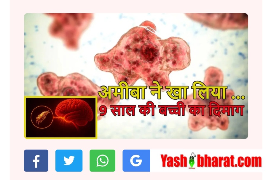 दिमाग खाने वाले अमीबा से 9 साल की बच्ची की मौत, स्वास्थ्य विभाग ने जारी किया अलर्ट; जानिए ब्रेन-ईटिंग अमीबा के लक्षण
