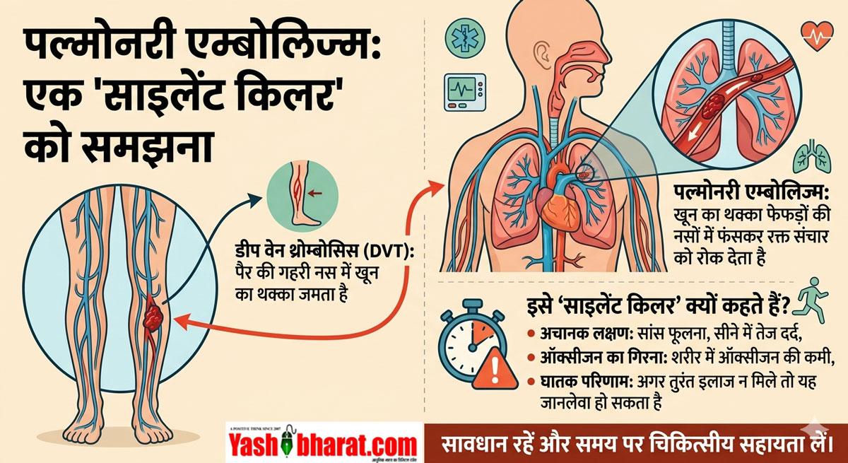 What is Pulmonary Embolism: फेफड़ों की इस जानलेवा बीमारी ने ली प्रतीक यादव की जान- जानें क्यों 'पल्मोनरी एम्बोलिज्म' को माना जाता है साइलेंट किलर