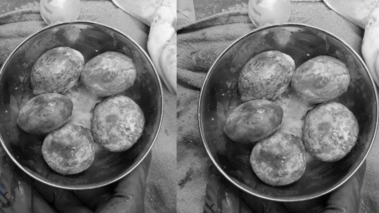 Medical Marvel: विशाखापत्तनम में डॉक्टरों का कमाल, मरीज के ब्लैडर से निकालीं मुर्गी के अंडे जितनी बड़ी 5 पथरियां 42 Medical Marvel: विशाखापत्तनम में डॉक्टरों का कमाल, मरीज के ब्लैडर से निकालीं मुर्गी के अंडे जितनी बड़ी 5 पथरियां