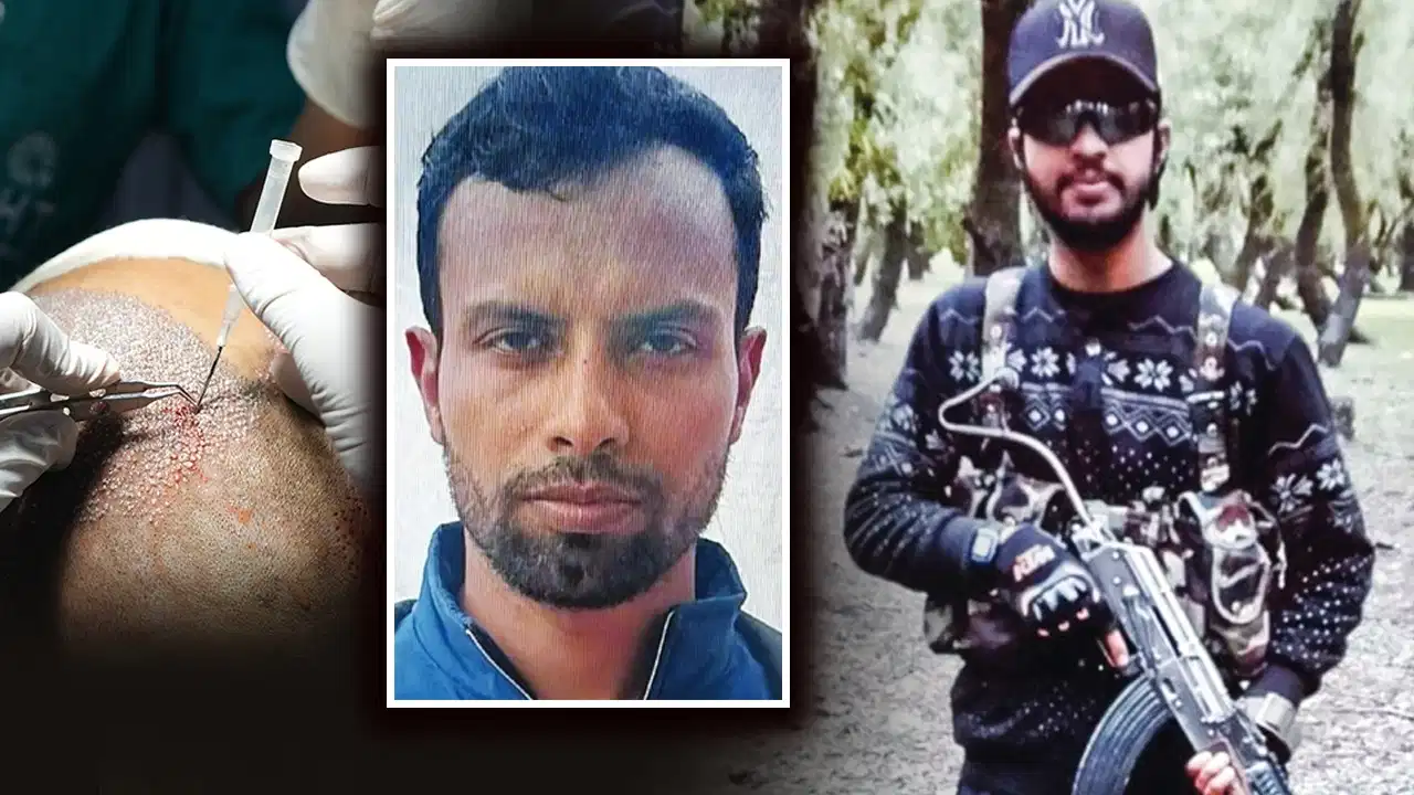 गंजेपन से परेशान लश्कर आतंकी ने श्रीनगर में कराया हेयर ट्रांसप्लांट, पाकिस्तानी आतंकी उस्मान जट्ट गिरफ्तार 22 गंजेपन से परेशान लश्कर आतंकी ने श्रीनगर में कराया हेयर ट्रांसप्लांट, पाकिस्तानी आतंकी उस्मान जट्ट गिरफ्तार