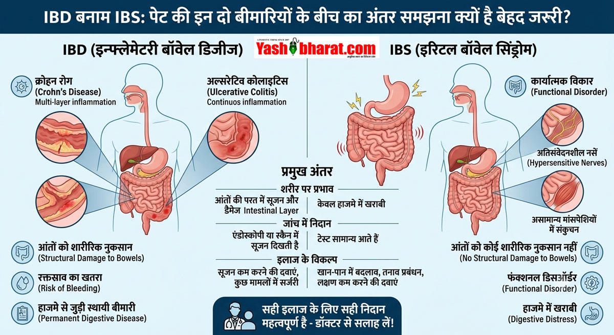 IBD vs IBS: पेट की इन दो बीमारियों के बीच का अंतर समझना क्यों है बेहद जरूरी?