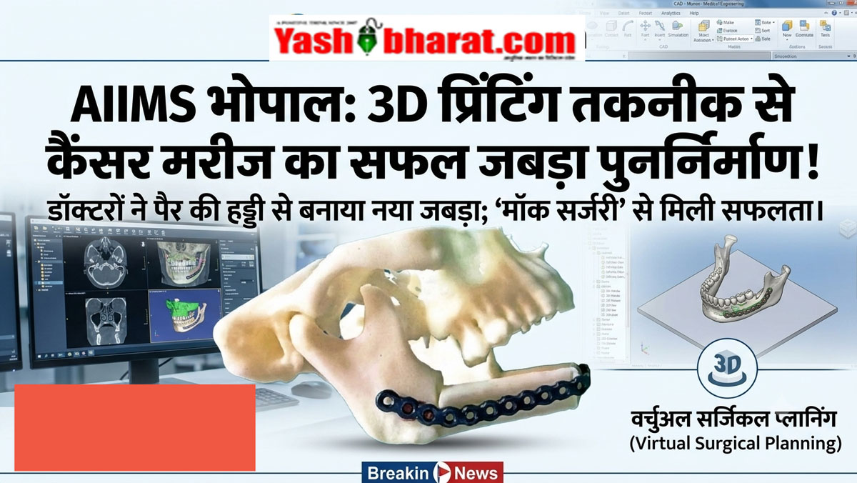 3D Printing Surgery AIIMS: एम्स भोपाल में 3D प्रिंटिंग तकनीक से सफल सर्जरी, जानिए पैर की हड्डी से कैसे बना नया जबड़ा